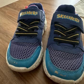 Skechers Deri Dökülmesi/Soyulması Hakkında