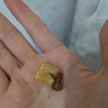 Oba Makarnanın İçinden Çıkan Madde