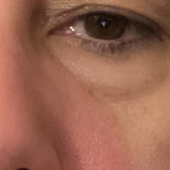 Cilt Alerjisi- Bioderma Pigmentbio Night Renewer Krem!