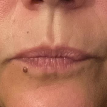 Cilt Alerjisi- Bioderma Pigmentbio Night Renewer Krem!