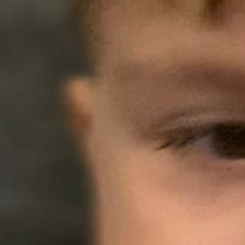 Dünya Göz Hastanesi Önce İnsanlık Anlayış Saygı Rica Ediyorum