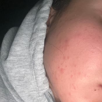 Gratis Yuz Bakim Kremi