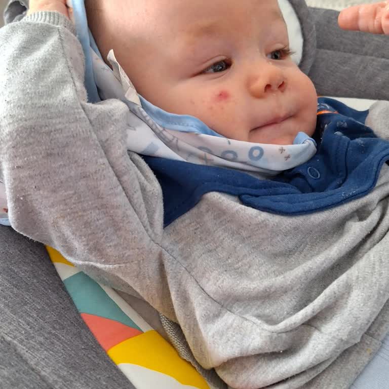 Mustela Şampuan Sivilce Yaptı