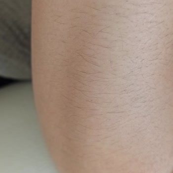 Dilan Polat Yalova Şubesi Lazer Epilasyon