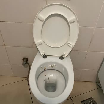 Sivas Numune Hastanesi Hastanedeki Temizlik Problemi