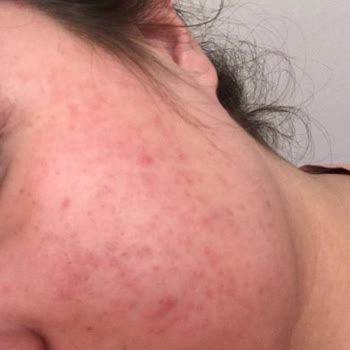 Maruderm Yüz Yıkama Jeli