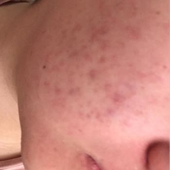 Maruderm Yüz Yıkama Jeli