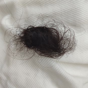 OGX Biotin Ve Kolajen Şampuanı Saçımda Dökülme, Diplerde Yanma Yaptı