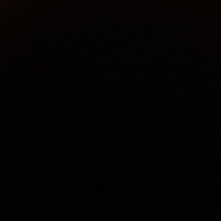 Renault Yetkili Servis Saçmalığı