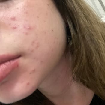 Gratis Beaulis Close İt Kapatıcı!