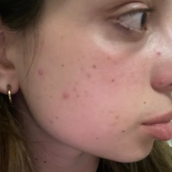 Gratis Beaulis Close İt Kapatıcı!