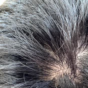 Head Shoulders Kepek Olmayan Saçımda Kepek Yaptı