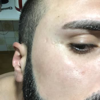 La Roche Posay Cicaplast B5 Serum 30 Ml