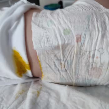 Prima Premium Care Bez Şikayetçiyim