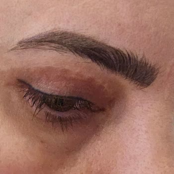 Saglikliveguzel.com Çorum'da Estetik Operasyon Sonrası Yaşanan Sorunlar