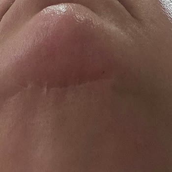 Saglikliveguzel.com Çorum'da Estetik Operasyon Sonrası Yaşanan Sorunlar