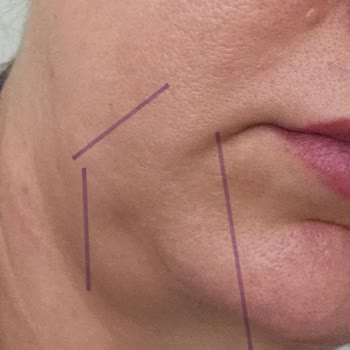 Saglikliveguzel.com Çorum'da Estetik Operasyon Sonrası Yaşanan Sorunlar