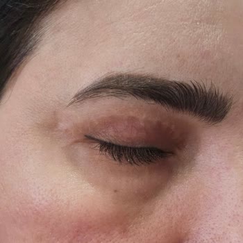 Saglikliveguzel.com Çorum'da Estetik Operasyon Sonrası Yaşanan Sorunlar