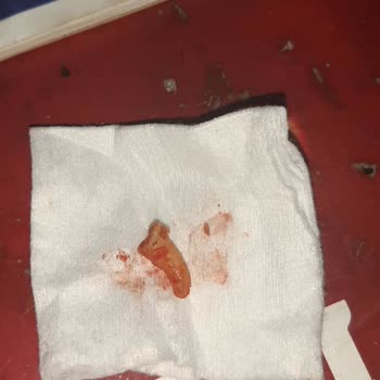 Mediadent Diş Tedavisinde Yaşanan Talihsiz Deneyim