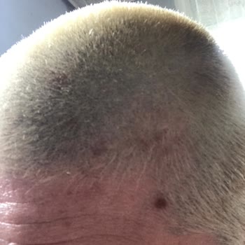 İgora Kaliteli Markanın Saçlarıma Verdiği Zarar