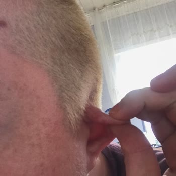 İgora Kaliteli Markanın Saçlarıma Verdiği Zarar