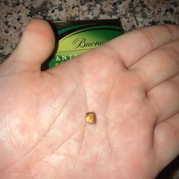 BİM Çikolatasının İçinden Taş Çıktı