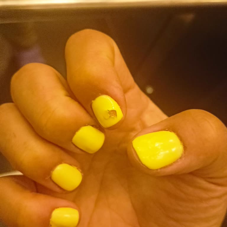 Rabia Ünlü Güzellik Merkezi Memnuniyetsizlik Ve Anlaşmazlık