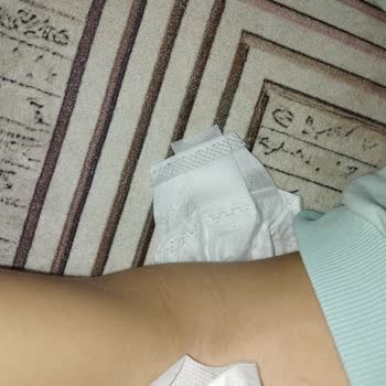 Baby Turco Bebek Bezi Yapışkanı Yok