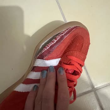 adidas Sorunlu Ürünün Arkasında Durmayan Şirket