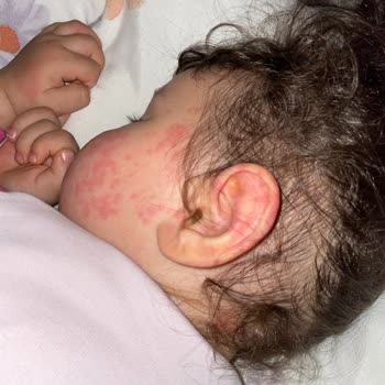 Dalin Çocuğuma Zarar Verdi!