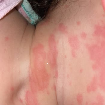 Dalin Çocuğuma Zarar Verdi!