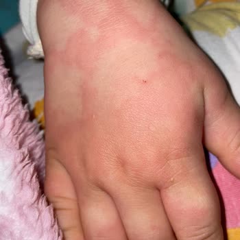 Dalin Çocuğuma Zarar Verdi!