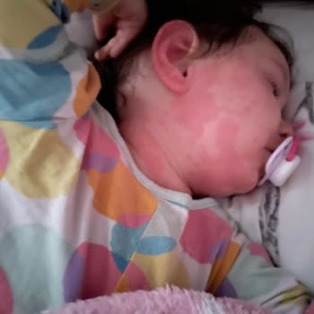 Dalin Çocuğuma Zarar Verdi!