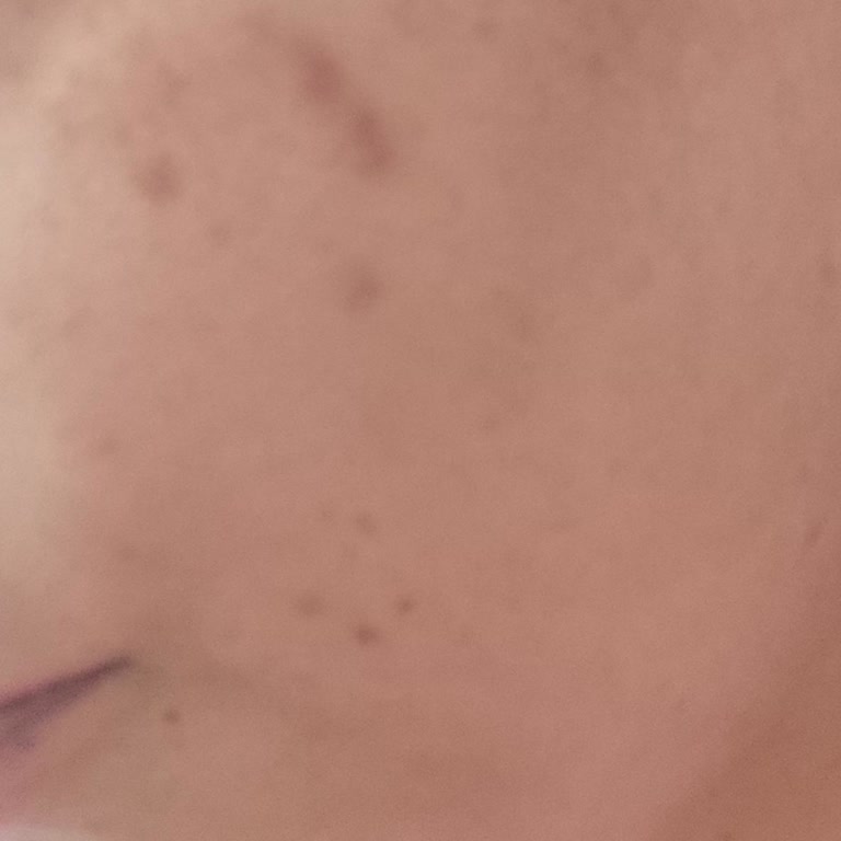 Climed Tedavi Merkezi Climed Bakırköy Şikayet