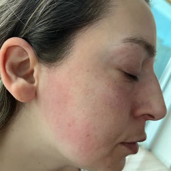 Bioderma Leke Karşıtı Güneş Kremi Hk.