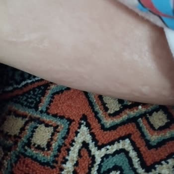 Göreme Eczanesi İade Almıyor Zorda Bırakıyor