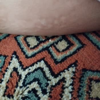 Göreme Eczanesi İade Almıyor Zorda Bırakıyor