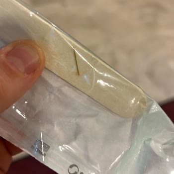 Hilton Kozyatağı Yemekten Çıkan Cisim Ve Doktor Bulunmaması