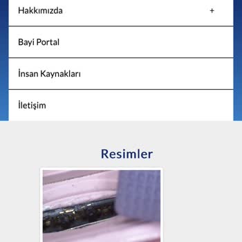 KVK TCL Saatimde SIM Kart Sorunu Ve Servis Deneyimim