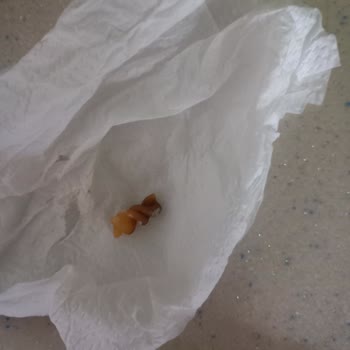 Nuh'un Ankara Makarnası Nuhun Ankara Makarnasının İçinden Küflü Siyah Makarna Çıktı