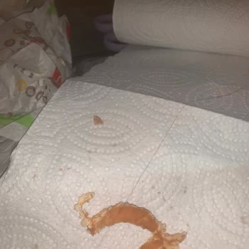 Burger King Hamburgerimde Saç Çıktı