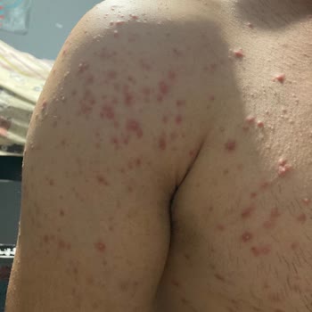 Trendyol Epify Tüy Dökücü Krem