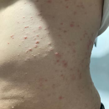 Trendyol Epify Tüy Dökücü Krem