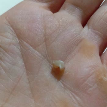 Eti Gıda Hijyen Sorunu: Browni'den Beklenmedik Misafir!
