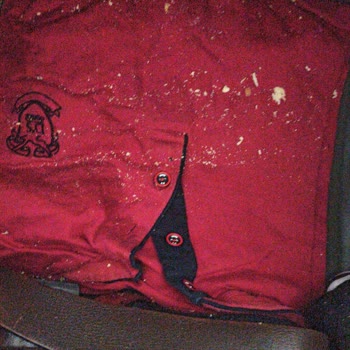 Anadolu Jet Yolculuğumda Valizim Hasar Gördü Ve Mağduriyet Yaşadım