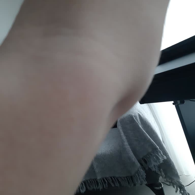 Bursa Şehir Hastanesi Romatoloji Bölümü Doktoru İle İlgili Şikayet