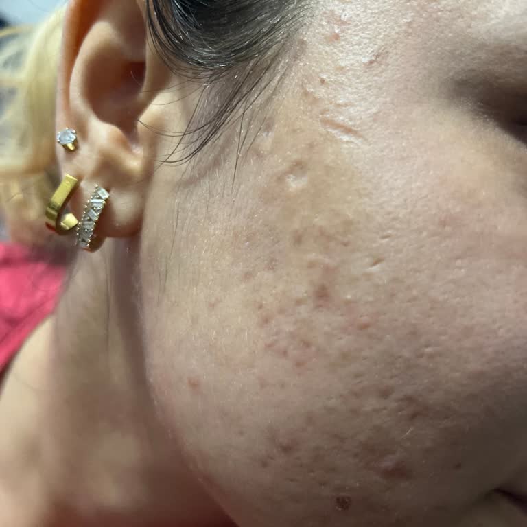 Aris Güzellik Merkezleri Yüzüm Çok Kötü