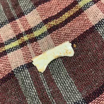 Sr Dönerden Aldığım Dönerin İçinden Plastik Çıktı.