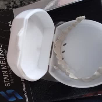 Pelav Ayakkabı Malzemeleri Kalitesiz Ürün Ve İletişimsizlik Sorunu