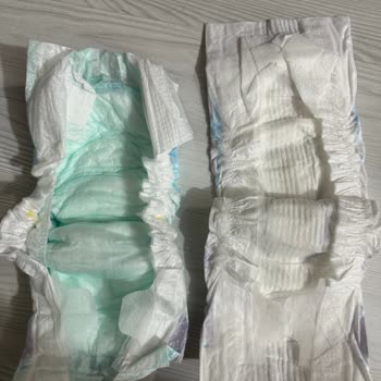 Migros'ta Satılan Molfix Bezin Orijinallik Şüphesi